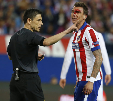 عکس: خون و خونریزی در دربی مادرید