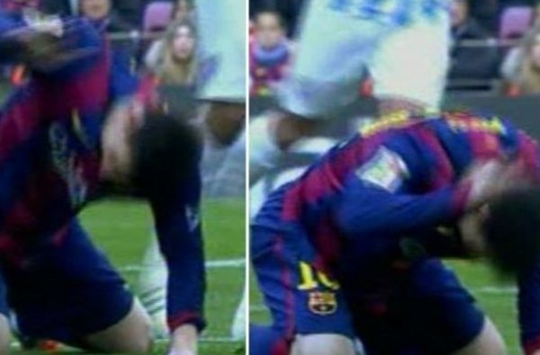 واکنش های عصبی مسی مقابل مالاگا(عکس)