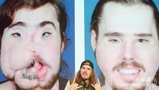 بلایی که این مرد جوان بر صورت خودش آورد + عکس 16+