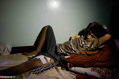 یکی از مجروحان حملات هوایی در بیمارستان 