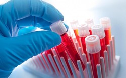 آزمایش ادرار چه بیماری هایی را مشخص می کند