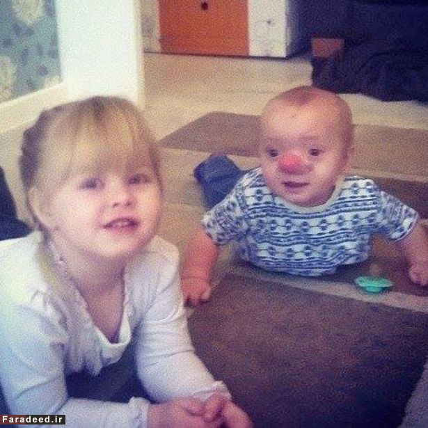 تصاویر/ پینوکیوی دنیای واقعی پیدا شد!