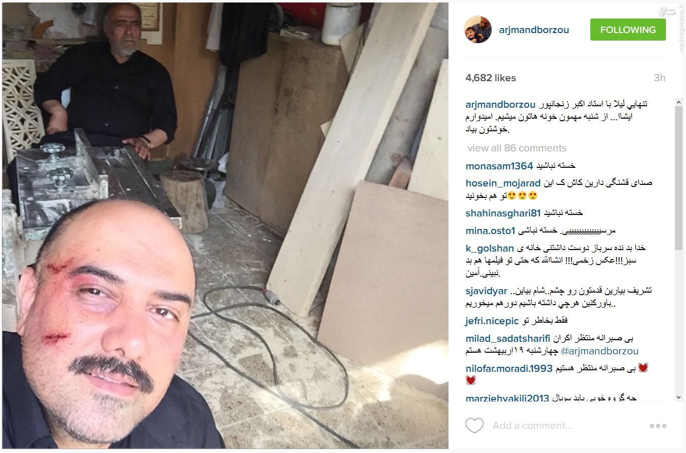 سلفی برزو ارجمند پس از کتک خوردن/عکس