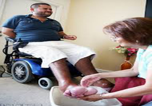 این مرد جوان عاجزانه خواستار قطع کردن پاهایش است + تصاویر