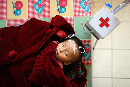 یک کودک دچار سوء تغذیه در بیمارستان 