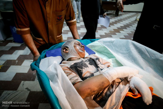 عکس: مصدومان چهارشنبه سوری در تهران
