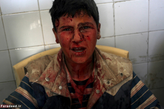 (تصاویر) کودکانی با رنج‌های بزرگ