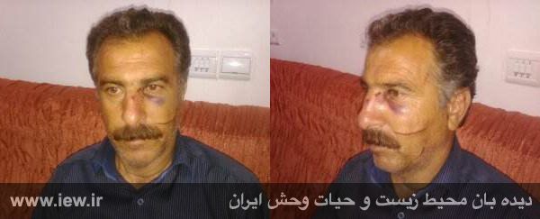 جراحت شدید محیط بان توسط شکارچیان در ایلام