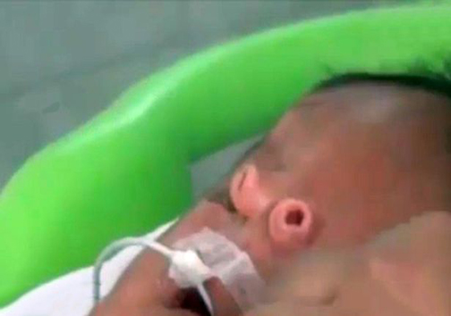 تولد نوزادی یا دوبینی + تصاویر