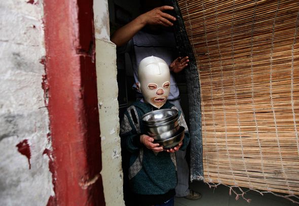 تصاویر : پسر بچه بدون چهره