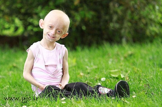 این پیرزن تنها 11 سال سن دارد+تصاویر