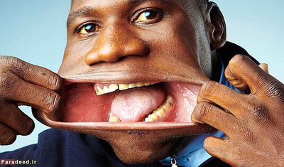  فرانسیسکو دومینگو ژاکیوم ۲۰ ساله اهل آنگولا توانست در مسابقه پهن ترین دهان جهان در رم با گذاشتن یک قوطی کوکا کولا در دهان خود با ۱۷ سانتی متر پهنا رکورد پهن ترین دهان جهان را بشکند.در مسابقه برگزار شده در رم همه با استفاده از فنجان قهوه ، بطری آب جو و چیزهای دیگر سعی کردن عنوان پهن ترین دهان جهان را از آن خود کنند ولی هیچکس نتوانست مانند فرانسیسکو که از نظر هیبت مانند یک فک آنگولایی می باشد یک بطری کوکا کولا را در دهان خود جای دهد.