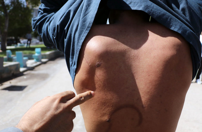 (تصاویر) بازسازی صحنه قتل در 