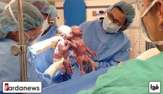 عکس/تولد دوقلوهای عاشق