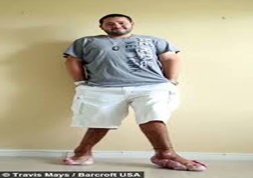 این مرد جوان عاجزانه خواستار قطع کردن پاهایش است + تصاویر