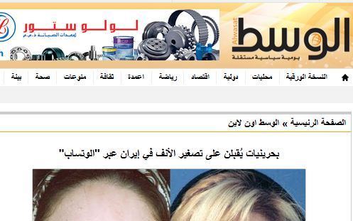 اقبال دختران و زنان بحرینی و کویتی به عمل زیبایی بینی در ایران با 